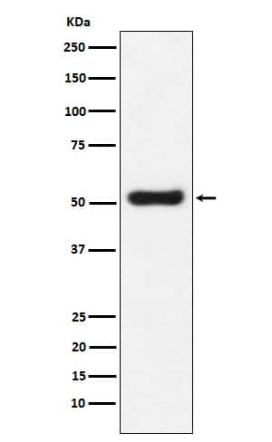 Western Blot: OLFM4 Antibody (SR1959) [NBP3-21911] - Western blot analysis using NBP3-21911 in LnCaP cell lysate.