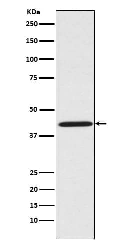 Western Blot: SPRY2 Antibody (SR1722) [NBP3-21915] - Western blot analysis using NBP3-21915 in HeLa cell lysate.