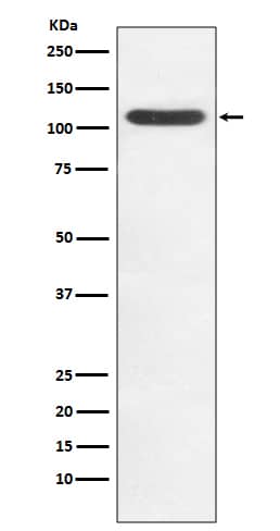 Western Blot: HIP1 Antibody (SR1072) [NBP3-21916] - Western blot analysis using NBP3-21916 in Jurkat cell lysate.