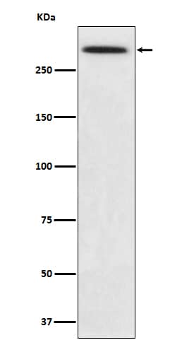 Western Blot: Spectrin alpha 1 Antibody (SR1450) [NBP3-21928] - Western blot analysis using NBP3-21928 in K562 cell lysate.