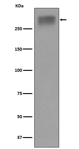 Western Blot: Thyroglobulin Antibody (SR1499) [NBP3-21930] - Western blot analysis using NBP3-21930 in Human thyroid lysate.