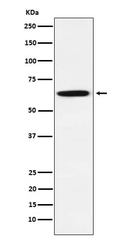 Western Blot: GRB7 Antibody (SR2057) [NBP3-21932] - Western blot analysis using NBP3-21932 in A431 cell lysate.