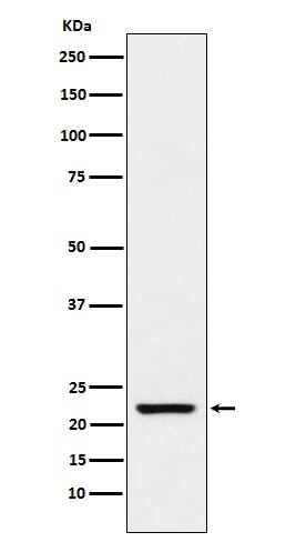 Western Blot: Transgelin/TAGLN/SM22 alpha Antibody (SR1369) [NBP3-21936] - Western blot analysis using NBP3-21936 in Human stomach lysate.