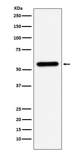 Western Blot: Carboxylesterase 1/CES1 Antibody (SR1990) [NBP3-21940] - Western blot analysis using NBP3-21940 in U937 cell lysate.