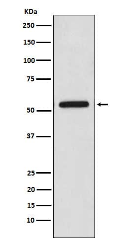 Western Blot: CaM Kinase II Antibody (SR1956) [NBP3-21943] - Western blot analysis using NBP3-21943 in HeLa cell lysate.