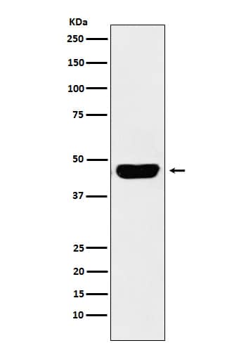 Western Blot: OX40/TNFRSF4 Antibody (SR1764) [NBP3-21947] - Western blot analysis using NBP3-21947 in Human fetal spleen lysate.