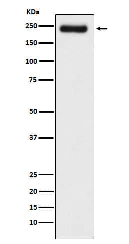 Western Blot: Laminin gamma 1 Antibody (SR1311) [NBP3-21953] - Western blot analysis using NBP3-21953 in A431 cell lysate.