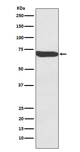 Western Blot: Frizzled-9 Antibody (SR2091) [NBP3-21955] - Western blot analysis using NBP3-21955 in Human Seminoma lysate.