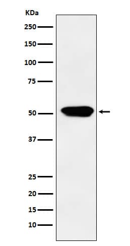 Western Blot: Cytochrome P450 4A Antibody (SR1876) [NBP3-21959] - Western blot analysis using NBP3-21959 in Human fetal kidney lysate.