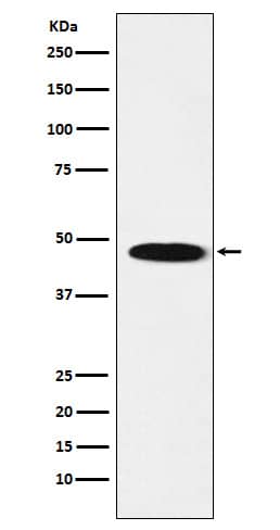 Western Blot: GABA-A R beta 1 Antibody (SR1833) [NBP3-21964] - Western blot analysis using NBP3-21964 in Human cerebellum lysate.