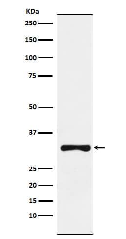 Western Blot: RYBP/DEDAF Antibody (SR1538) [NBP3-21976] - Western blot analysis using NBP3-21976 in SW480 cell lysate.