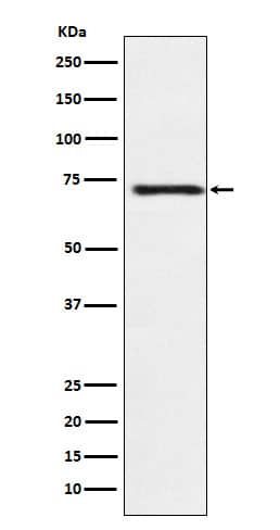 Western Blot: Guanylyl Cyclase beta 1 Antibody (SR2169) [NBP3-21987] - Western blot analysis using NBP3-21987 in Human fetal brain lysate.