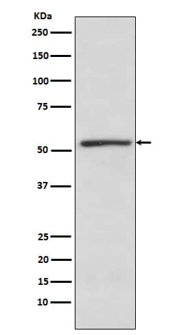 Western Blot: TBLR1 Antibody (SR2012) [NBP3-21990] - Western blot analysis using NBP3-21990 in K562 cell lysate.