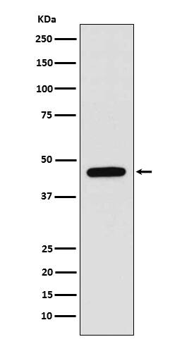 Western Blot: WIPI1 Antibody (SR1849) [NBP3-21991] - Western blot analysis using NBP3-21991 in A375 cell lysate.