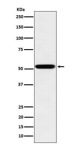 Western Blot: IgG2 Antibody (SR1938) [NBP3-21994] - Western blot analysis of IgG2 expression in Human spleen lysate. 