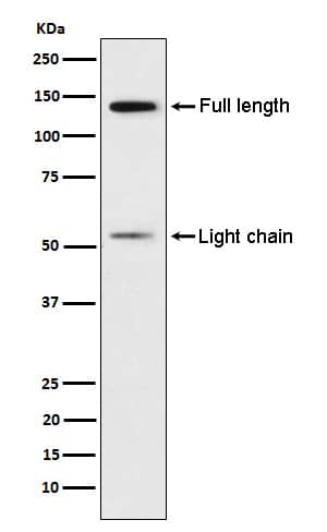 Western Blot: Kininogen 1 Antibody (SR2002) [NBP3-22001] - Western blot analysis using NBP3-22001 in Human platelet lysate.