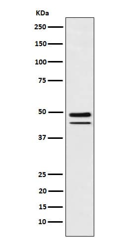 Western Blot: Brachyury Antibody (SR1807) [NBP3-22002] - Western blot analysis using NBP3-22002 in MUG-Chor1 (human sacral bone chordoma) cell lysate.