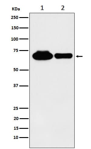 Western Blot Methyltransferase like 3 Antibody (SR2153)