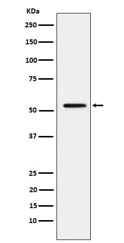 Western Blot: MMP-1 Antibody (SR1951) [NBP3-22010] - Western blot analysis using NBP3-22010 in A431 cell lysate.