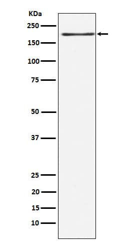 Western Blot: LRP-6 Antibody (SR1271) [NBP3-22014] - Western blot analysis using NBP3-22014 in Jurkat cell lysate.