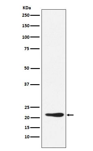 Western Blot: GDF-3 Antibody (SR1219) [NBP3-22018] - Western blot analysis using NBP3-22018 in 293T cell lysate.