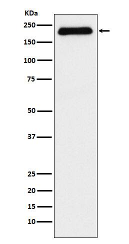 Western Blot: ATAD2 Antibody (SR1273) [NBP3-22019] - Western blot analysis using NBP3-22019 in MCF-7 cell lysate.