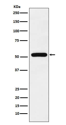 Western Blot: TAB1 Antibody (SR1999) [NBP3-22022] - Western blot analysis using NBP3-22022 in MCF-7 cell lysate.