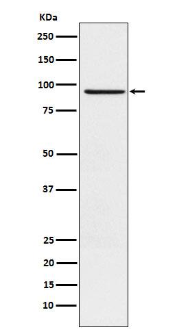 Western Blot: RAP1GAP Antibody (SR2304) [NBP3-22026] - Western blot analysis using NBP3-22026 in SH-SY5Y cell lysate.