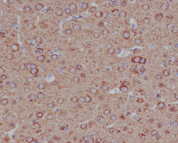 Immunohistochemistry: beta II Tubulin Antibody (SR1867) [NBP3-22028] - Immunohistochemical analysis of paraffin-embedded mouse brain, using NBP3-22028.