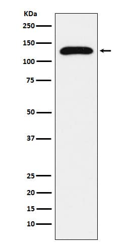 Western Blot: TRPC1 Antibody (SR1100) [NBP3-22029] - Western blot analysis using NBP3-22029 in HepG2 cell lysate.