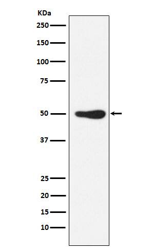 Western Blot: FOXL2 Antibody (SR1880) [NBP3-22032] - Western blot analysis using NBP3-22032 in Jurkat cell lysate.