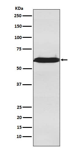 Western Blot: U2AF2 Antibody (SR1970) [NBP3-22034] - Western blot analysis using NBP3-22034 in Jurkat cell lysate.