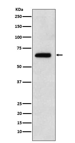 Western Blot: EBF-1 Antibody (SR2090) [NBP3-22035] - Western blot analysis using NBP3-22035 in Raji cell lysate.