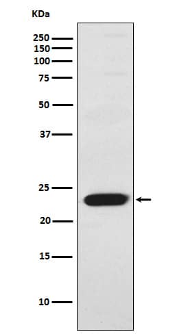 Western Blot: Troponin I type 2 (fast skeletal) Antibody (SR1334) [NBP3-22036] - Western blot analysis using NBP3-22036 in Human skeletal muscle lysate.