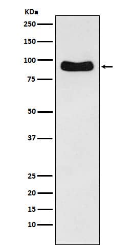 Western Blot: ODF2 Antibody (SR2297) [NBP3-22037] - Western blot analysis using NBP3-22037 in Hela cell lysate.