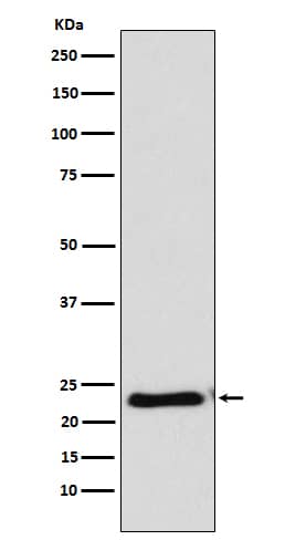 Western Blot: RAIDD/CRADD Antibody (SR1357) [NBP3-22040] - Western blot analysis using NBP3-22040 in HeLa cell lysate.