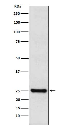 Western Blot: TPPP/p25 Antibody (SR1385) [NBP3-22044] - Western blot analysis using NBP3-22044 in SHSY5Y cell lysate.