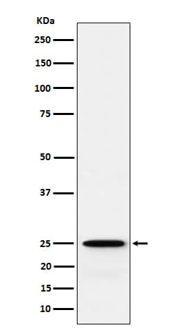 Western Blot: Glutathione S Transferase kappa 1 Antibody (SR1382) [NBP3-22046] - Western blot analysis using NBP3-22046 in 293T cell lysate.