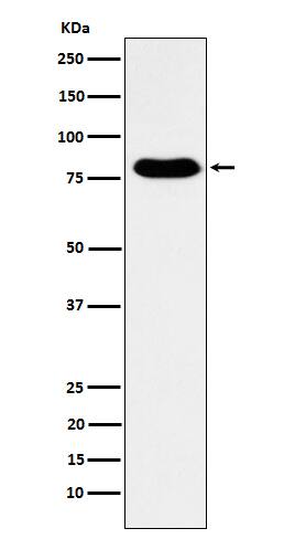 Western Blot: GTPBP4 Antibody (SR2224) [NBP3-22047] - Western blot analysis using NBP3-22047 in Human fetal kidney lysate.