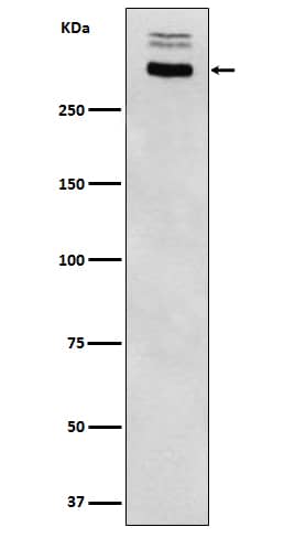 Western Blot: Thyroglobulin Antibody (SR1494) [NBP3-22051] - Western blot analysis using NBP3-22051 in Human thyroid lysate lysate.