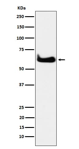 Western Blot: TCP1 alpha Antibody (SR2043) [NBP3-22063] - Western blot analysis using NBP3-22063 in HeLa cell lysate.