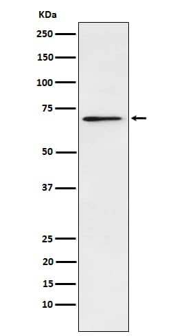 Western Blot: Plastin L Antibody (SR2136) [NBP3-22068] - Western blot analysis using NBP3-22068 in Jurkat cell lysate.