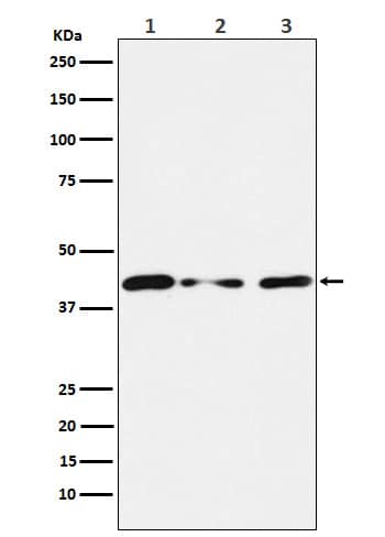 Western Blot: TIN2 Antibody (SR1681) [NBP3-22077] - Western blot analysis using NBP3-22077 in (1) HUVEC cell lysate; (2) NIH/3T3 cell lysate; (3) PC12 cell lysate.