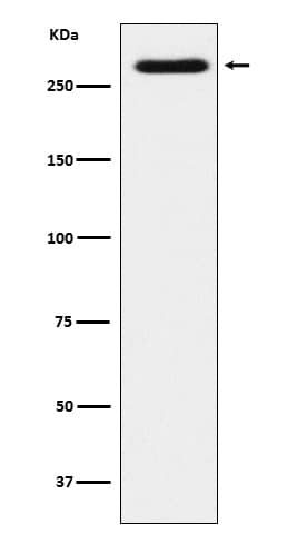 Western Blot: SorLA Antibody (SR1433) [NBP3-22079] - Western blot analysis using NBP3-22079 in SH-SY5Y cell lysate.