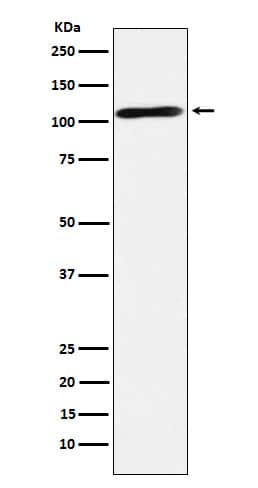 Western Blot: Epac2 Antibody (SR1071) [NBP3-22082] - Western blot analysis using NBP3-22082 in Human fetal brain lysate.