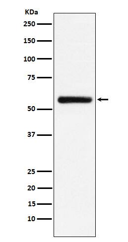 Western Blot: STK33 Antibody (SR2024) [NBP3-22084] - Western blot analysis using NBP3-22084 in HEK293 cell lysate.