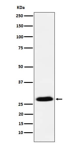 Western Blot: Goosecoid Antibody (SR1466) [NBP3-22090] - Western blot analysis using NBP3-22090 in MCF7 cell lysate.