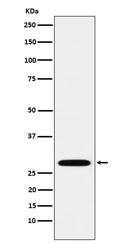 Western Blot: Proteasome 20S alpha 3 Antibody (SR1471) [NBP3-22095] - Western blot analysis using NBP3-22095 in A549 cell lysate.