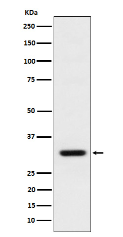 Western Blot: BCL2L12 Antibody (SR1529) [NBP3-22097] - Western blot analysis using NBP3-22097 in MCF7 cell lysate.