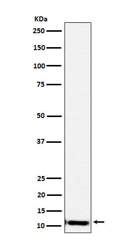 Western Blot: SPINK1 Antibody (SR1084) [NBP3-22104] - Western blot analysis using NBP3-22104 in Human pancreas lysate.